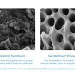 Two SEM images: left “Standard Treatment” reveals granular, particle-laden surface; right “GentleWave® Procedure” shows smooth, homogeneous texture with efficacy note